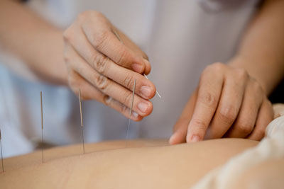 Traditional Complementary Medicine (T&CM)